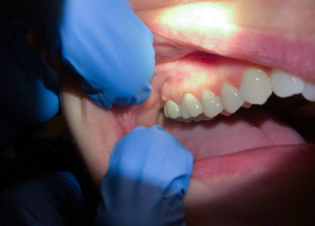 Best Teeth Whitening  in Good Hope, AL