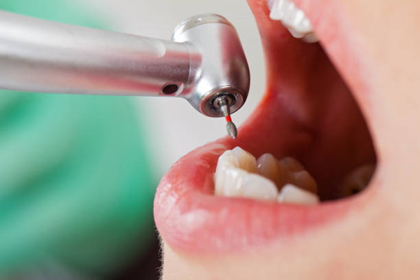 Best Knocked-Out Tooth Emergency  in Good Hope, AL